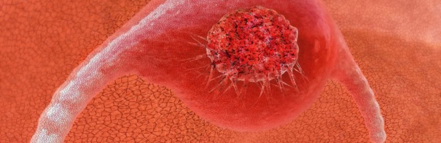 New Diagnostic Method Of Cancer Tumours Discovered For The First Time